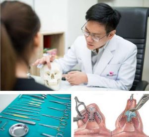 เครื่องมือ หมอกันมือผ่าโอเพ่น จมูกโอเพ่น หมอกัน ธีระธรฌ์คลินิก
