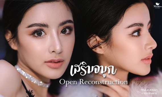 เสริมจมูกOpen-หมอกัน-ธีระธรฌ์คลินิก-จมูกใหญ่ จมูกชมพู่ แก้ที่ไหนดี-เสริมจมูกที่ไหนดี-เสริมจมูกปรับโหงวเฮ้ง-เลือกทรงจมูกยังไงให้เข้ากับหน้า-รีวิวทรงจมูกสายหวาน