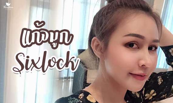แก้จมูก-จมูกsixlock-หมอกัน-ธีระธรฌ์คลินิก