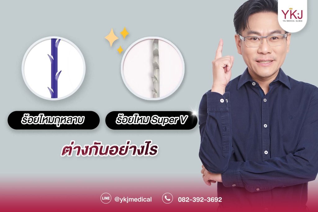 ปกไหมกุหลายต่างกับไหม Super V อย่างไร