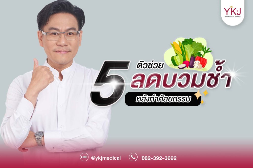 ปก5 ตัวช่วยลดบวมช้ำหลังทำศัลยกรรม
