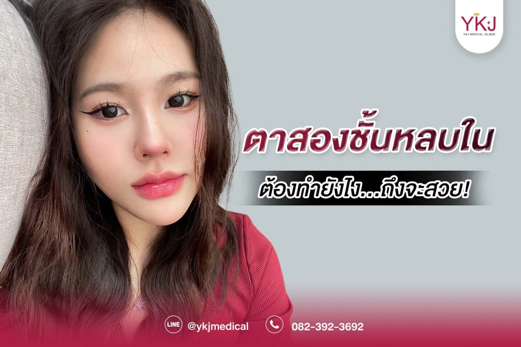 ตาสองชั้นหลบใน