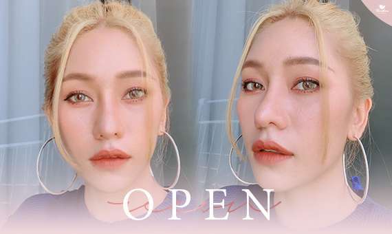 แก้จมูก Open-แก้จมูกโอเพ่น-หมอกัน-ธีระธรฌ์คลินิก-จมูก-รีวิว