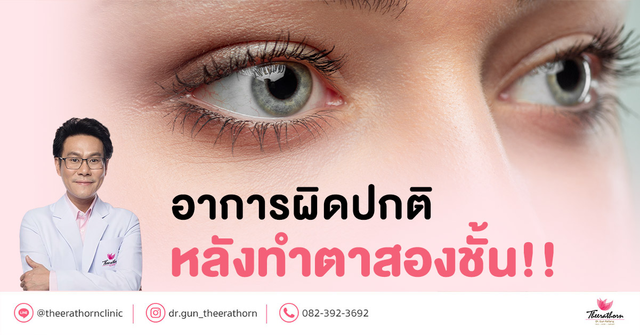 อาการผิดปกติ หลังทำตาสองชั้น อาการแบบไหนต้องรีบมาหาหมอ