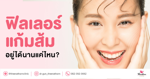 ฟิลเลอร์แก้มส้ม เหมาะกับใคร ฉีดแล้วอยู่ได้นานแค่ไหน?