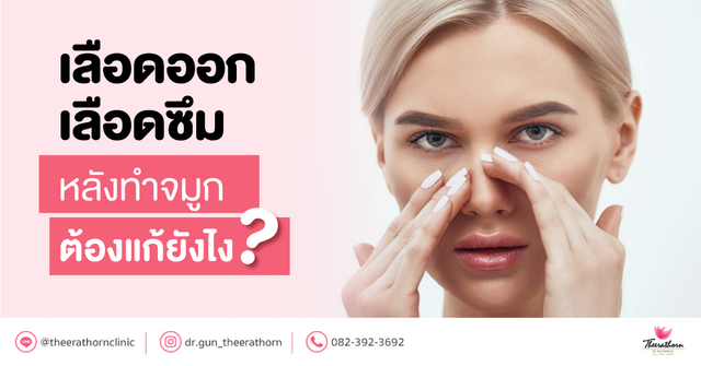 เลือดออก เลือดซึม อาการหลังทำจมูกผิดปกติ ต้องแก้ยังไง , bleeding after rhinoplasty