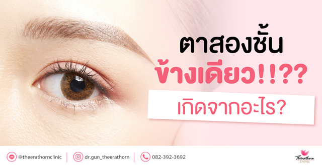ตาสองชั้นข้างเดียว