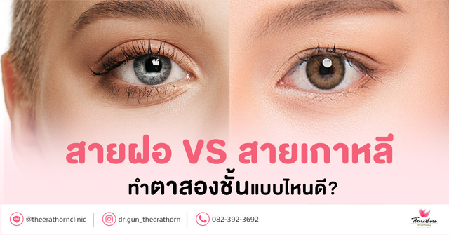 สายฝอ VS สายเกาหลี ทําตาสองชั้นแล้วไม่สวย เพราะต้องเลือกให้เป็น