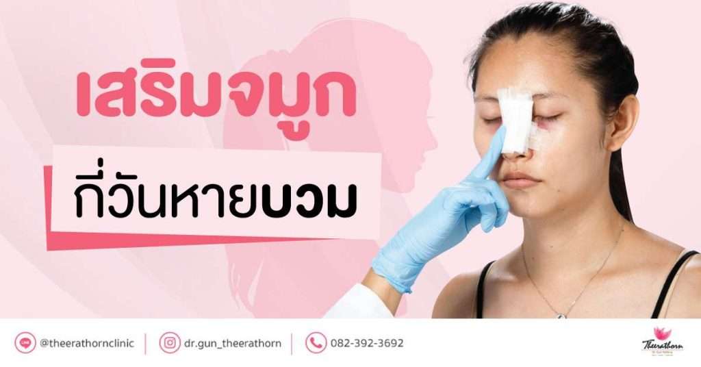G:\Shared drives\Maxideastudio Team A\03.1 Theerathornclinic\#1 File (Complete File)\File-SEO Artwork\2021\December\บทความหมอกัน 01 kw เสริมจมูกกี่วันหายบวม