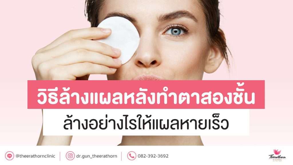 วิธีล้างแผลหลังทำตาสองชั้น ล้างอย่างไรให้แผลหายเร็ว