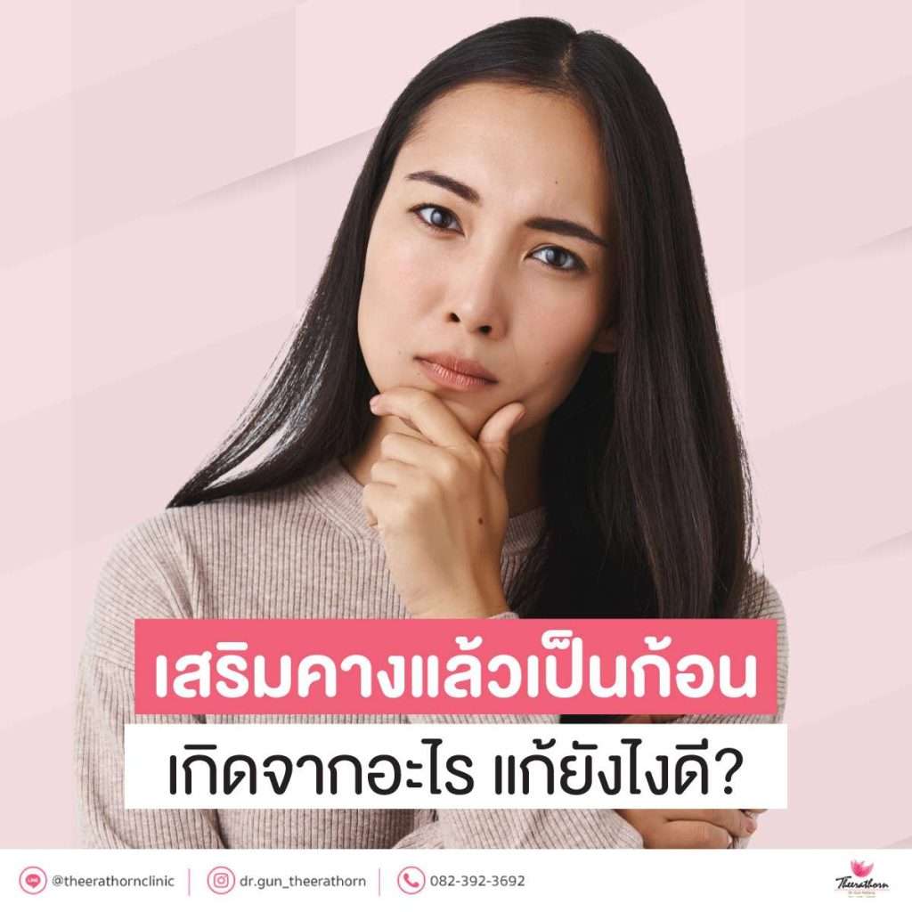 เสริมคางแล้วเป็นก้อน เกิดจากอะไร แก้ยังไงดี?