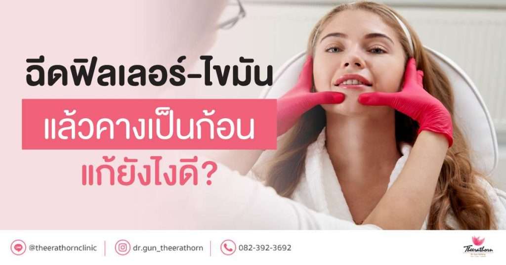 ฉีดฟิลเลอร์-ไขมัน แล้วคางเป็นก้อน แก้ยังไงดี?