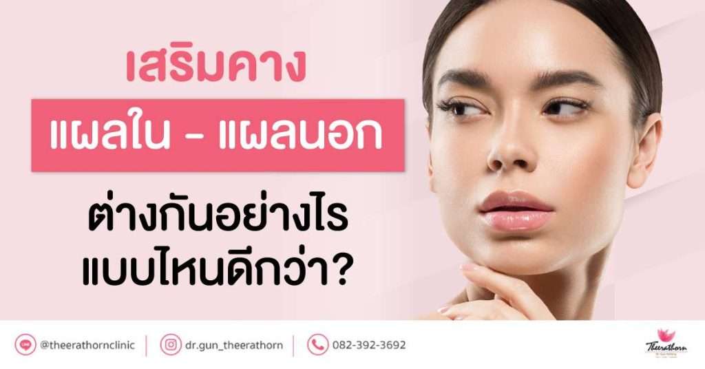 เสริมคาง แผลใน - แผลนอก ต่างกันอย่างไร แบบไหนดีกว่า?