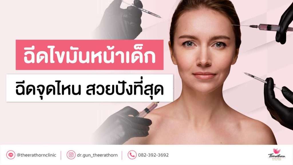 ฉีดไขมันหน้าเด็ก ฉีดจุดไหน สวยปังที่สุด