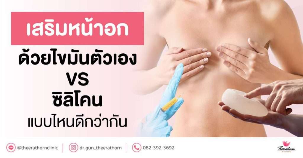 เสริมหน้าอกด้วยไขมันตัวเอง VS ซิลิโคน แบบไหนดีกว่ากัน