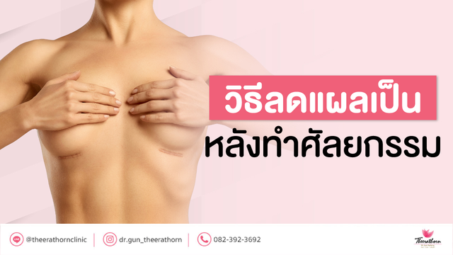 วิธีดูแลแผล ป้องกันแผลเป็น ลดแผลเป็น หลังทำศัลยกรรม