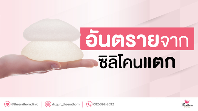 อันตรายจาก ซิลิโคนแตก สิ่งต้องระวังหากซิลิโคนเสริมเต้านมแตก