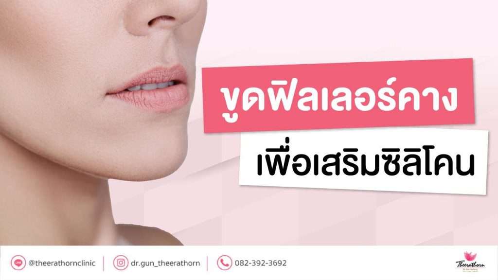 ขูดฟิลเลอร์คาง เพื่อเสริมซิลิโคน