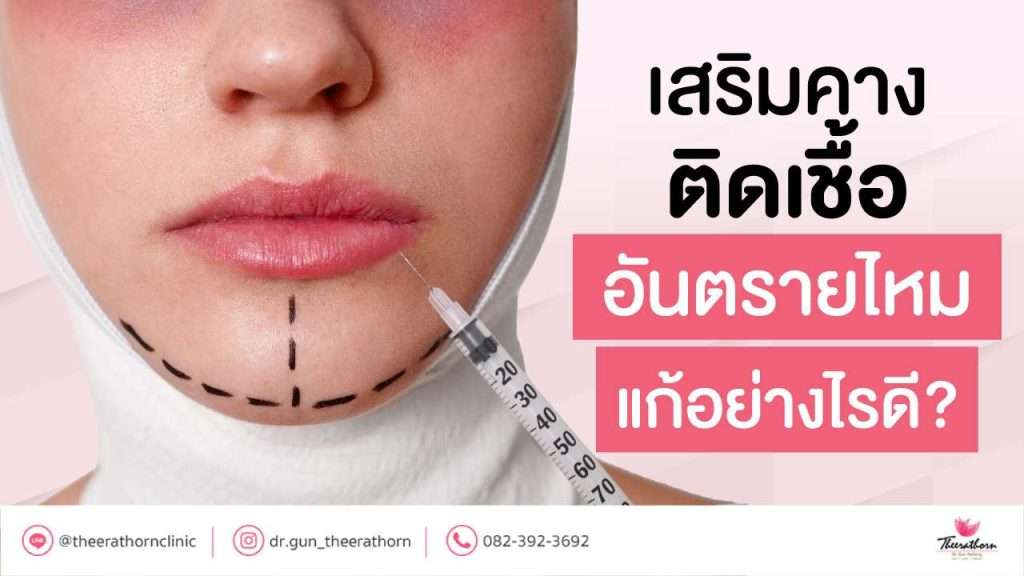 เสริมคาง ติดเชื้อ อันตรายไหม แก้อย่างไรดี?