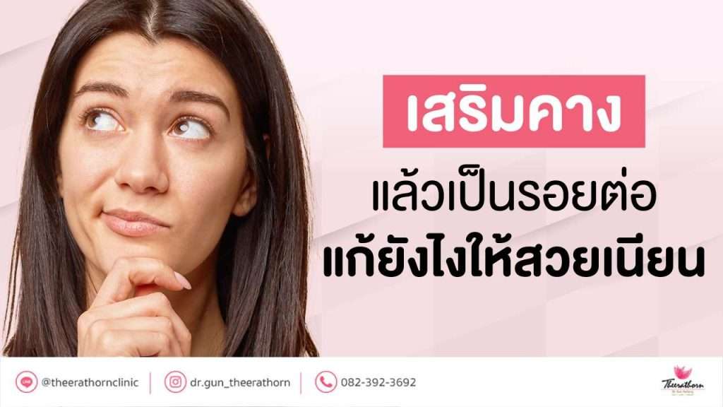 เสริมคางแล้วเป็นรอยต่อ แก้ยังไงให้สวยเนียน