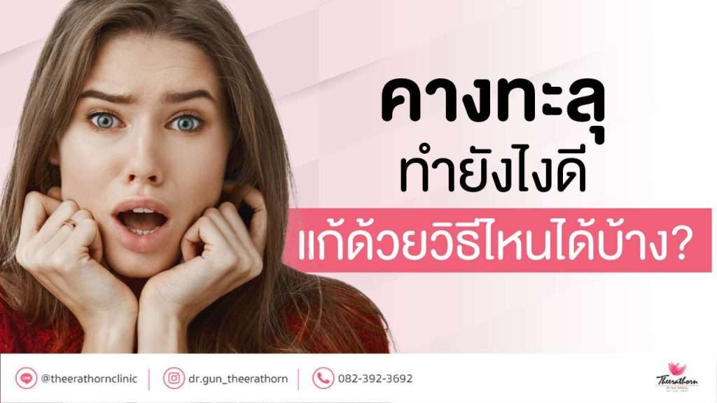 คางทะลุ ทำยังไงดี แก้ด้วยวิธีไหนได้บ้าง?