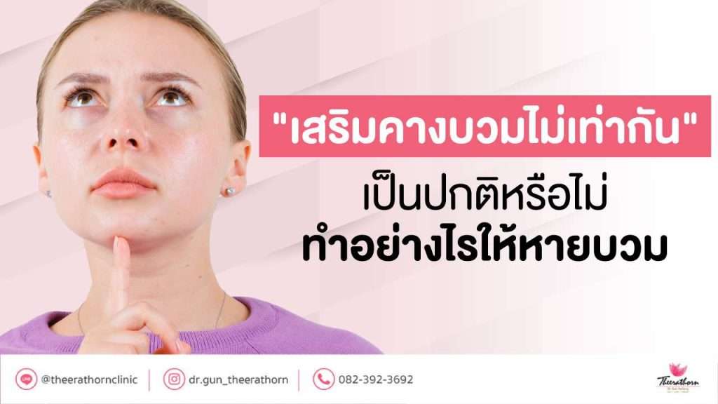 "เสริมคางบวมไม่เท่ากัน" เป็นปกติหรือไม่ ทำอย่างไรให้หายบวม