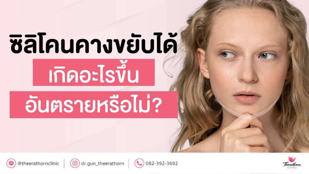 ซิลิโคนคางขยับได้ เกิดอะไรขึ้น อันตรายหรือไม่?