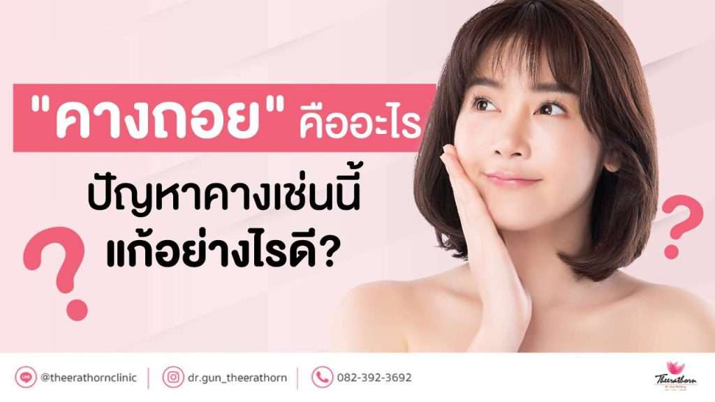 "คางถอย" คืออะไร ปัญหาคางเช่นนี้แก้อย่างไรดี?