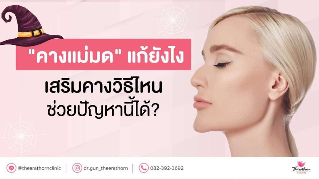 "คางแม่มด" แก้ยังไง เสริมคางวิธีไหนช่วยปัญหานี้ได้?