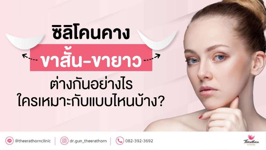 ซิลิโคนคางขาสั้น-ขายาว ต่างกันอย่างไร ใครเหมาะกับแบบไหนบ้าง?