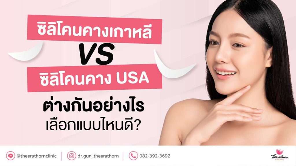 ซิลิโคนคางเกาหลี VS ซิลิโคนคาง USA ต่างกันอย่างไร เลือกแบบไหนดี?