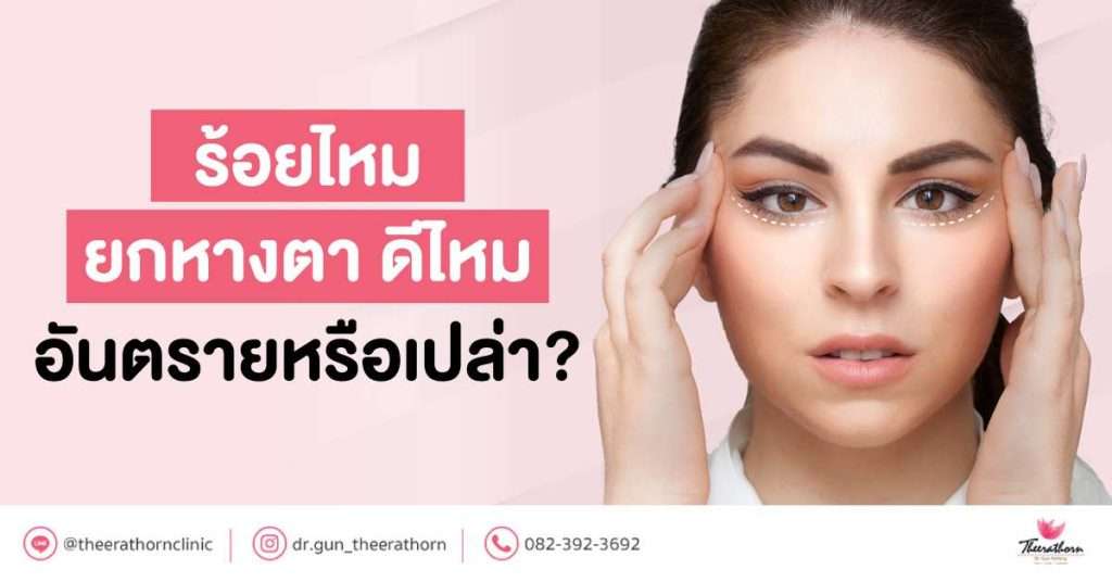 ร้อยไหมยกหางตา ดีไหม อันตรายหรือเปล่า?