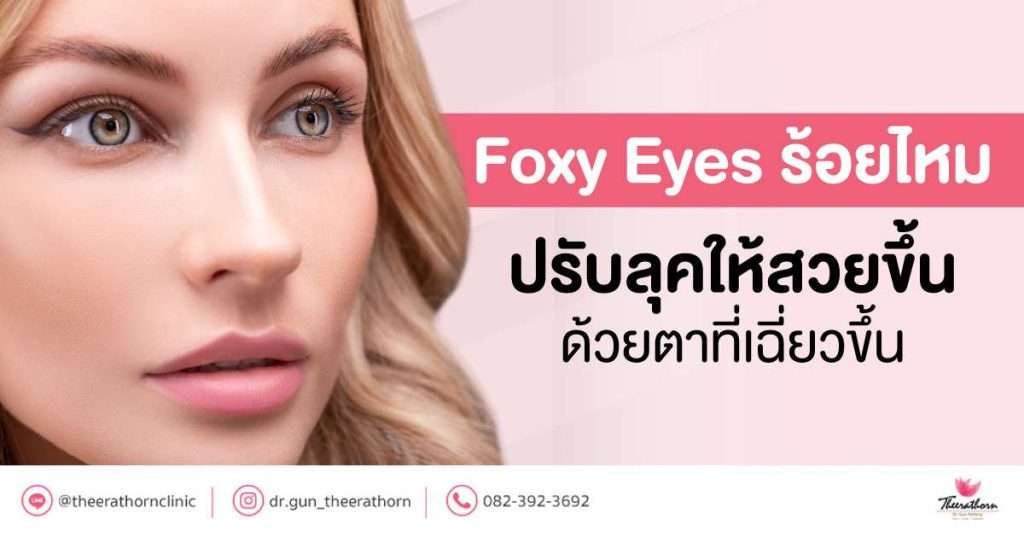 foxy eyes ร้อยไหม ปรับลุคให้สวยขึ้นด้วยตาที่เฉี่ยวขึ้น