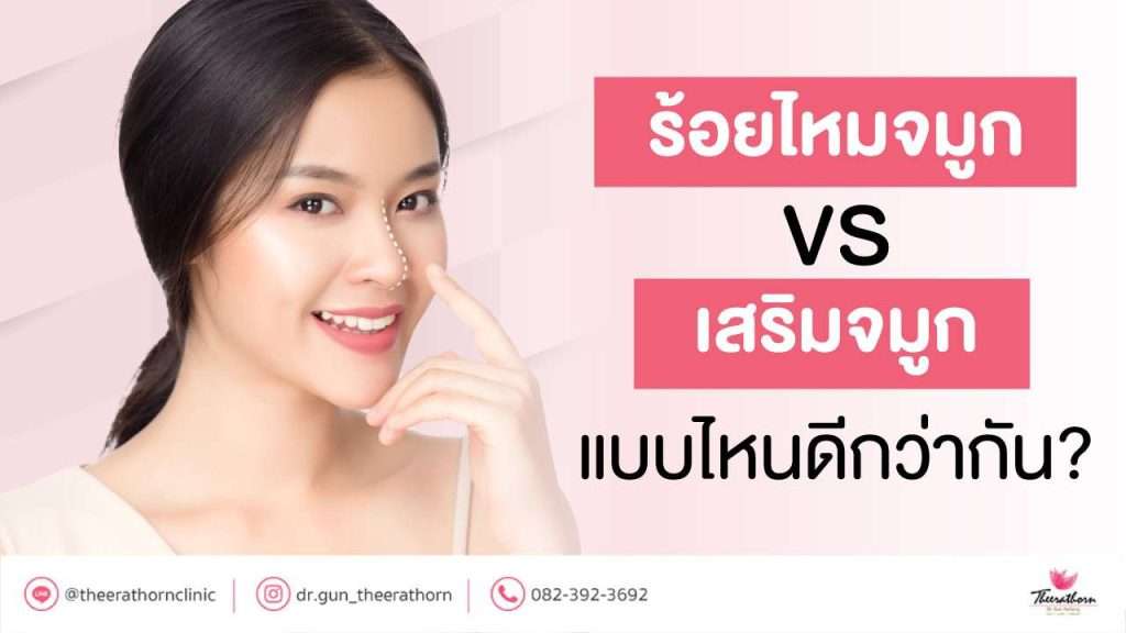 ร้อยไหมจมูก vs เสริมจมูก แบบไหนดีกว่ากัน?