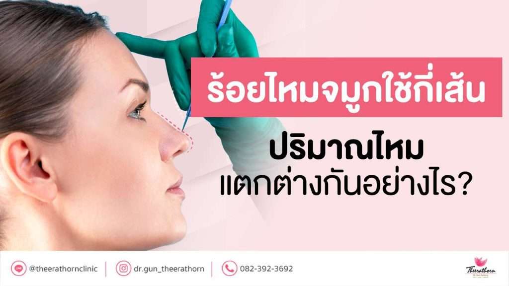 ร้อยไหมจมูกใช้กี่เส้น ปริมาณไหมแตกต่างกันอย่างไร?
