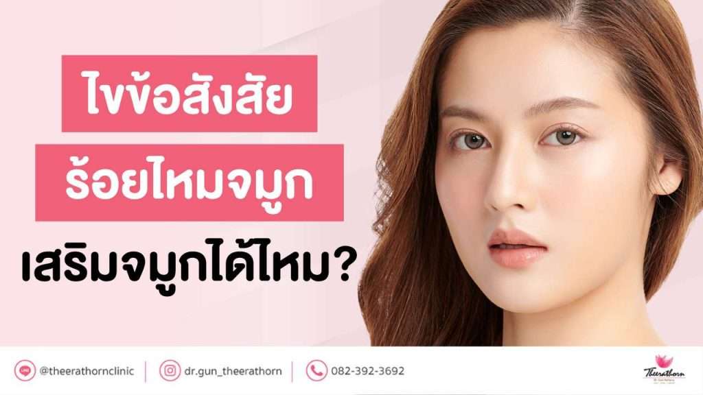 ไขข้อสังสัย ร้อยไหมจมูก เสริมจมูกได้ไหม?
