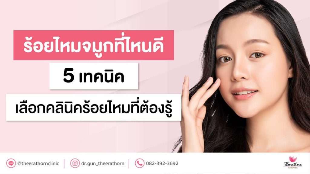 ร้อยไหมจมูกที่ไหนดี 5 เทคนิคเลือกคลินิคร้อยไหมที่ต้องรู้