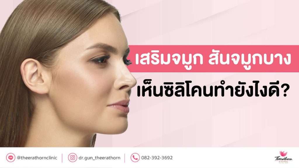 เสริมจมูก สันจมูกบาง เห็นซิลิโคน ทำยังไงดี?