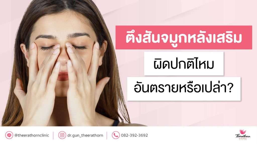 ตึงสันจมูกหลังเสริม ผิดปกติไหม อันตรายหรือเปล่า?