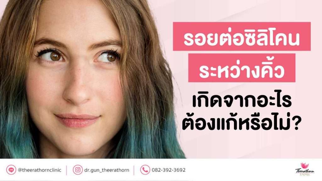 รอยต่อซิลิโคนระหว่างคิ้ว เกิดจากอะไร ต้องแก้หรือไม่?