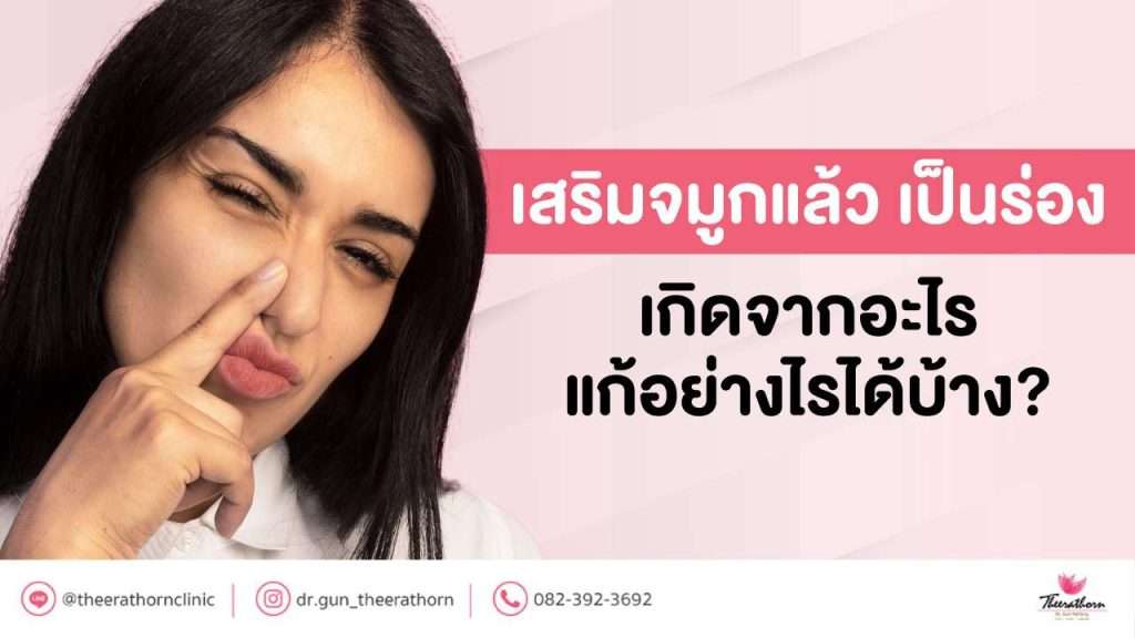 เสริมจมูกแล้ว เป็นร่อง เกิดจากอะไร แก้อย่างไรได้บ้าง?