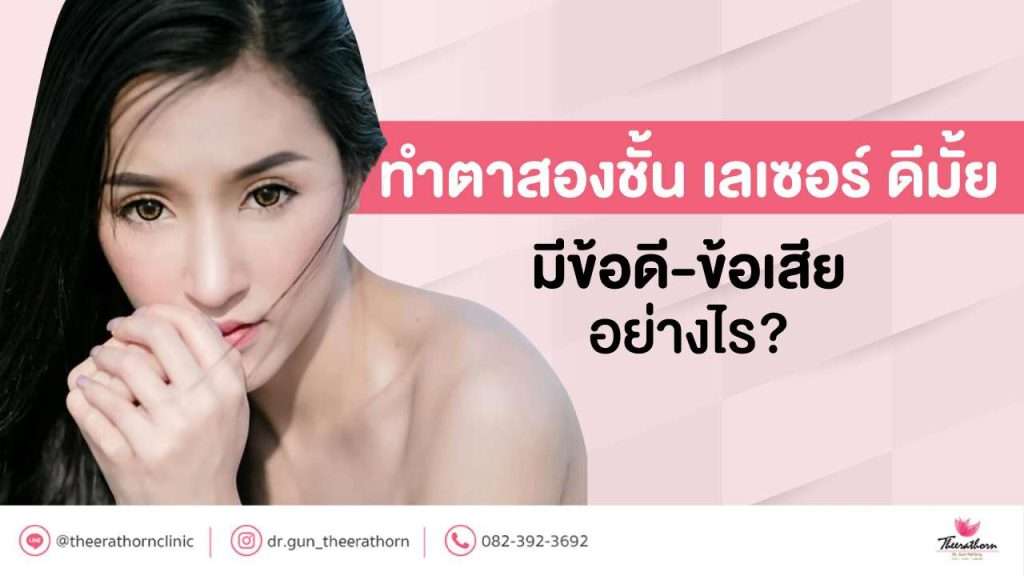 ทําตาสองชั้น เลเซอร์ ดีมั้ย มีข้อดี-ข้อเสีย อย่างไร?