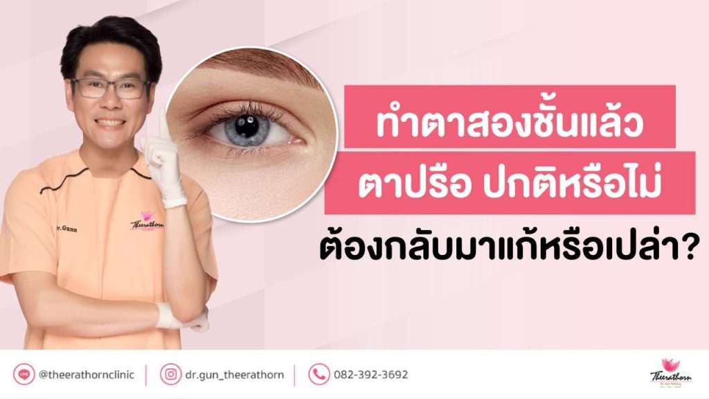 ทํา ตาสองชั้นแล้ว ตาปรือ ปกติหรือไม่ ต้องกลับมาแก้หรือเปล่า?