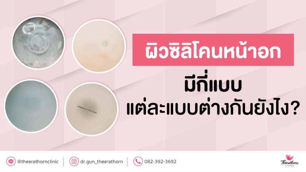 ผิวซิลิโคนหน้าอก มีกี่แบบ แต่ละแบบต่างกันยังไง?