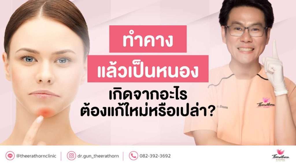 ทำคาง แล้ว เป็นหนอง เกิดจากอะไร ต้องแก้ใหม่หรือเปล่า?