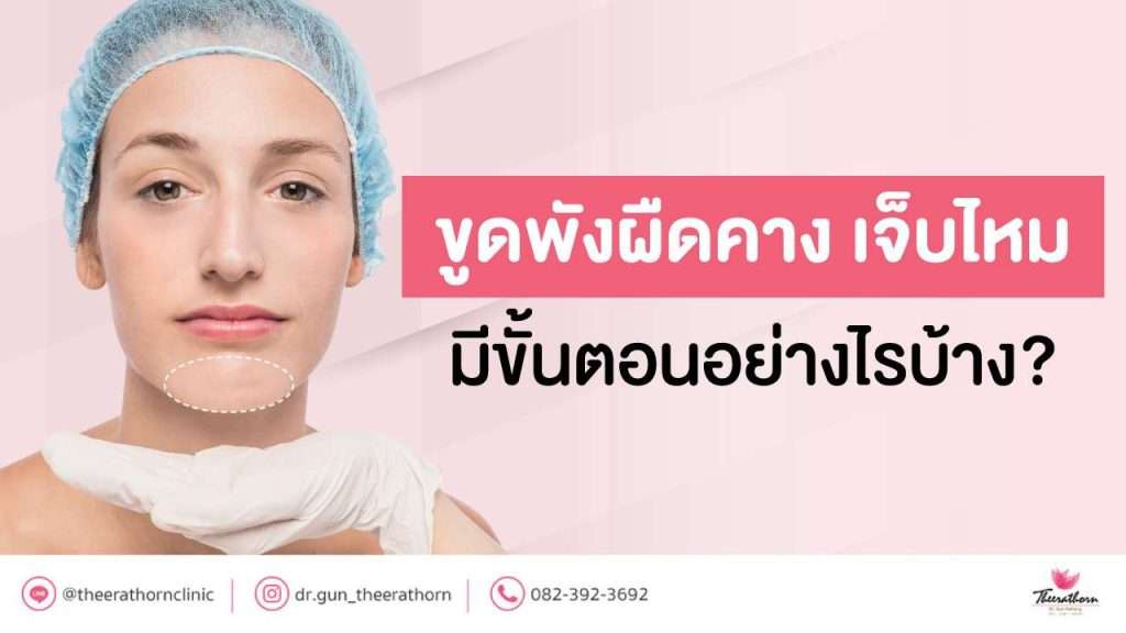 ขูดพังผืดคาง เจ็บไหม มีขั้นตอนอย่างไรบ้าง?