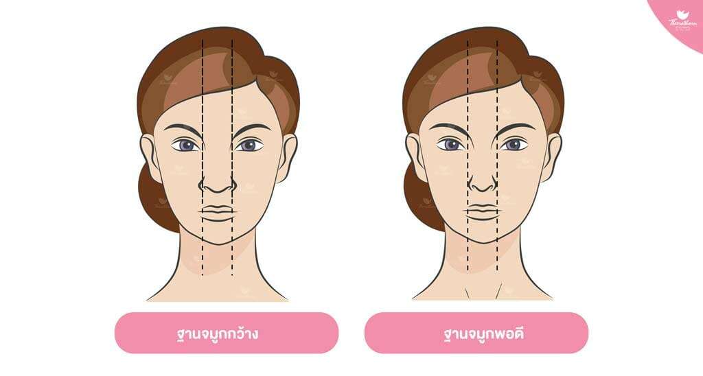 ฐานจมูกกว้าง