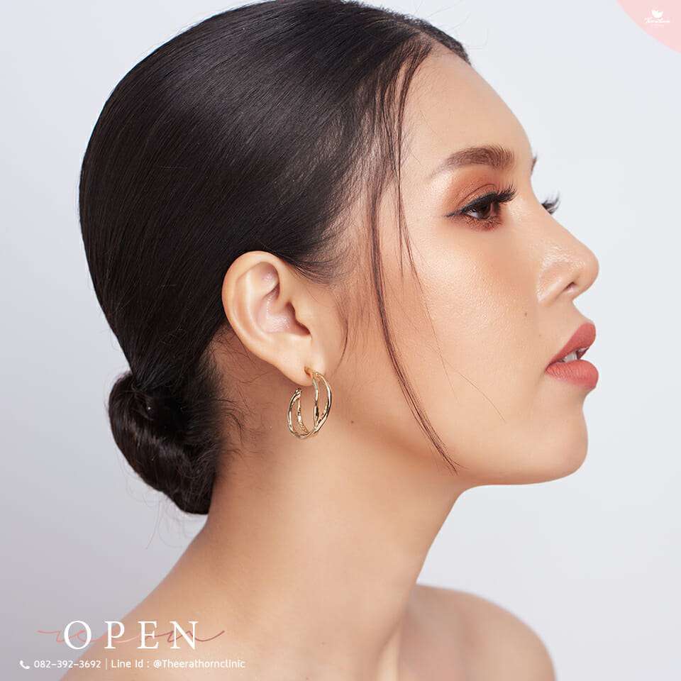 แก้จมูก, จมูกบางใส, จมูกทะลุ