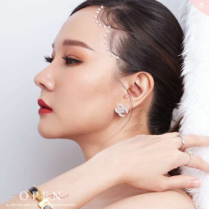 แก้จมูก, จมูกสั้นมาก