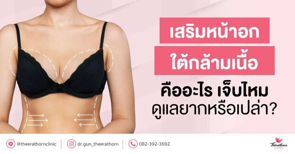 เสริมหน้าอกใต้กล้ามเนื้อ คืออะไร เจ็บไหม ดูแลยากหรือเปล่า?